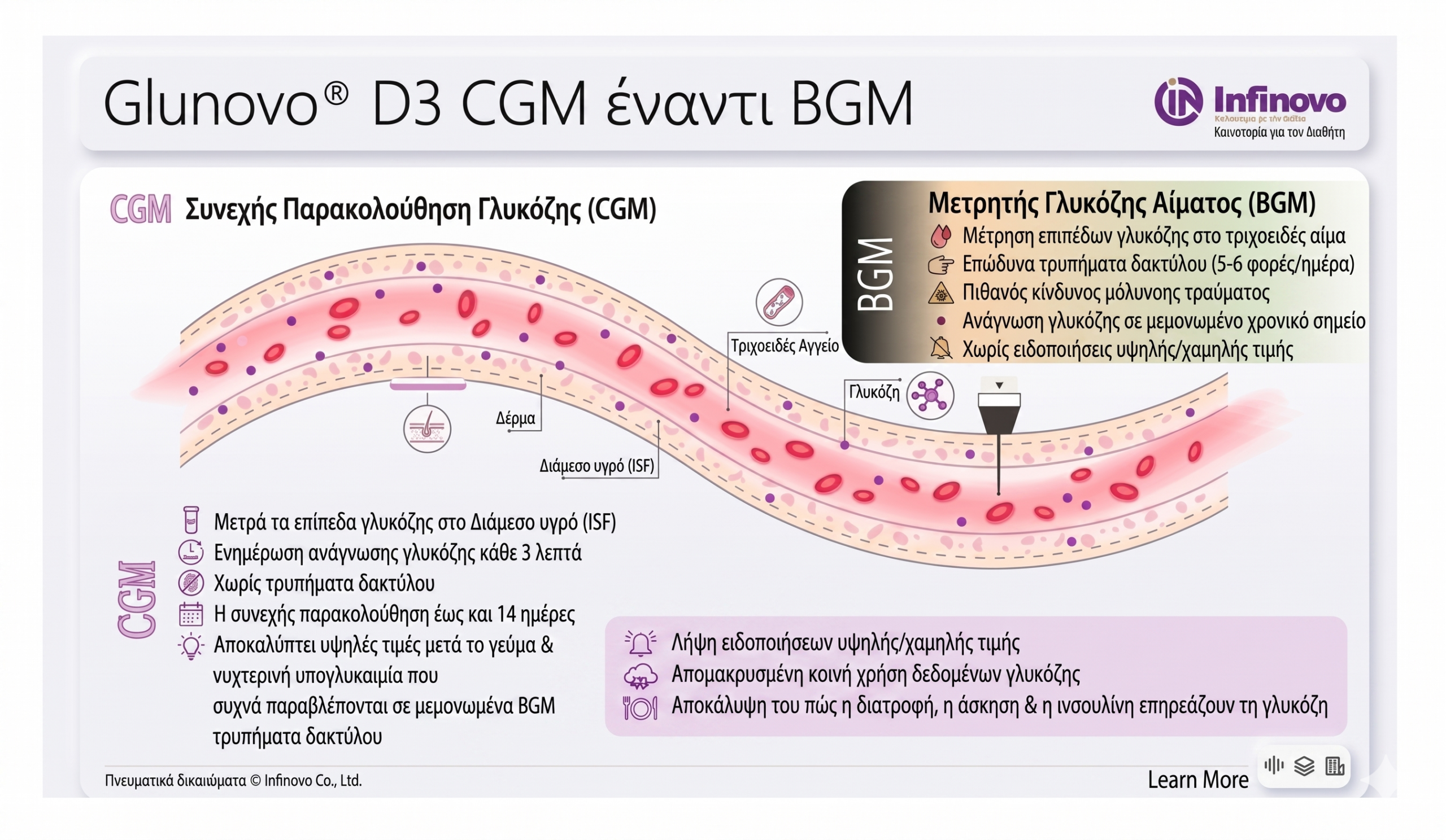 CGM vs BGM